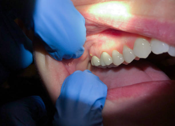 Best Orthodontic Emergency Dentist in Providence Village, TX
