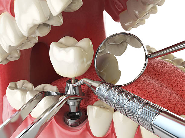 Best Emergency Dentist for Special Needs Patients in Providence Village, TX