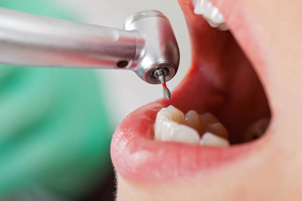 Best Holiday Emergency Dentist in Providence Village, TX